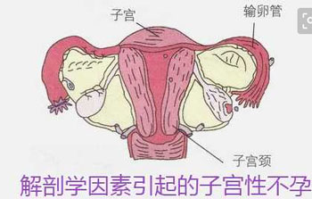 虎门女性为什么会患上宫颈性不孕?